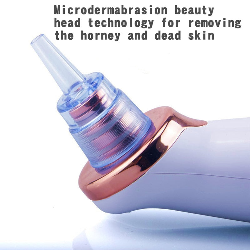 Electric Facial Blackhead Remover