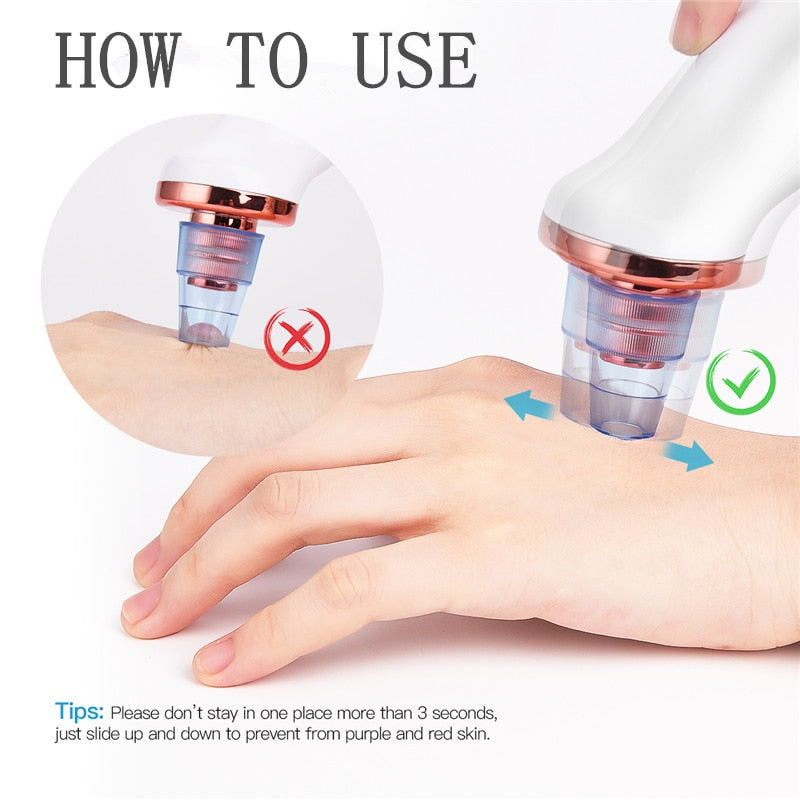 Electric Facial Blackhead Remover