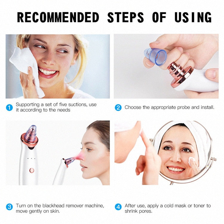 Electric Facial Blackhead Remover